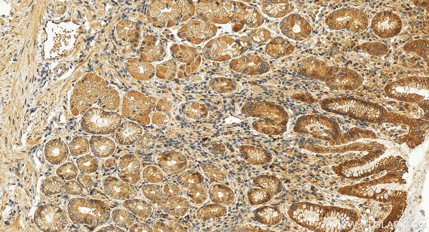 IHC staining of human stomach using 10536-1-AP