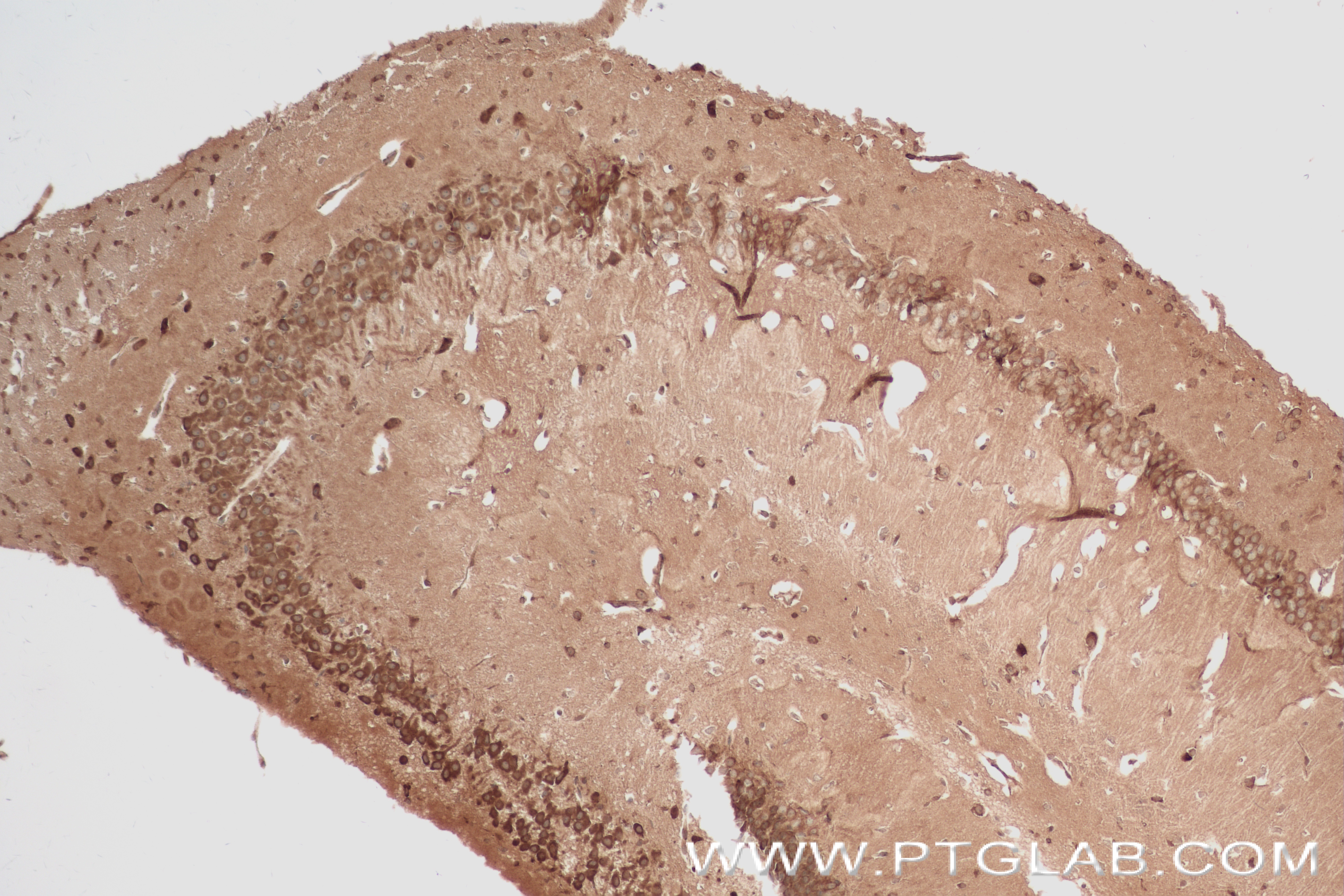 IHC staining of mouse brain using 84438-6-RR (same clone as 84438-6-PBS)