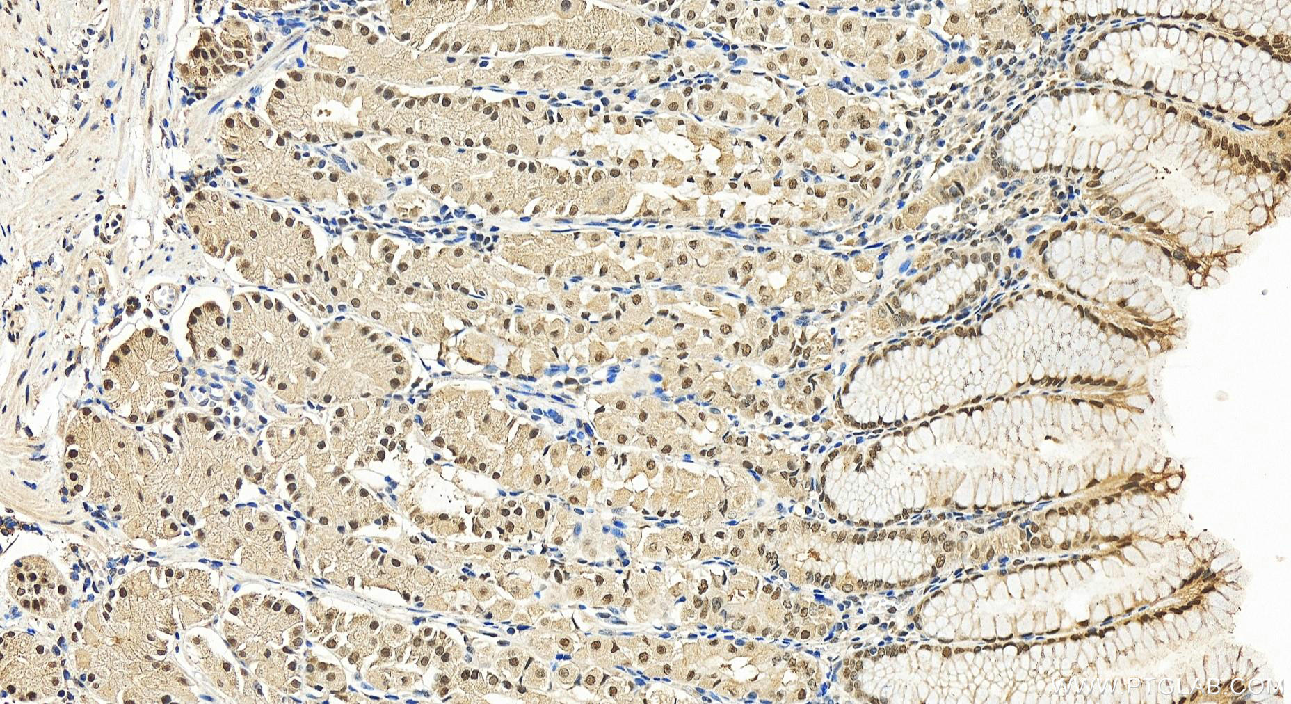 IHC staining of human stomach using 11357-1-AP