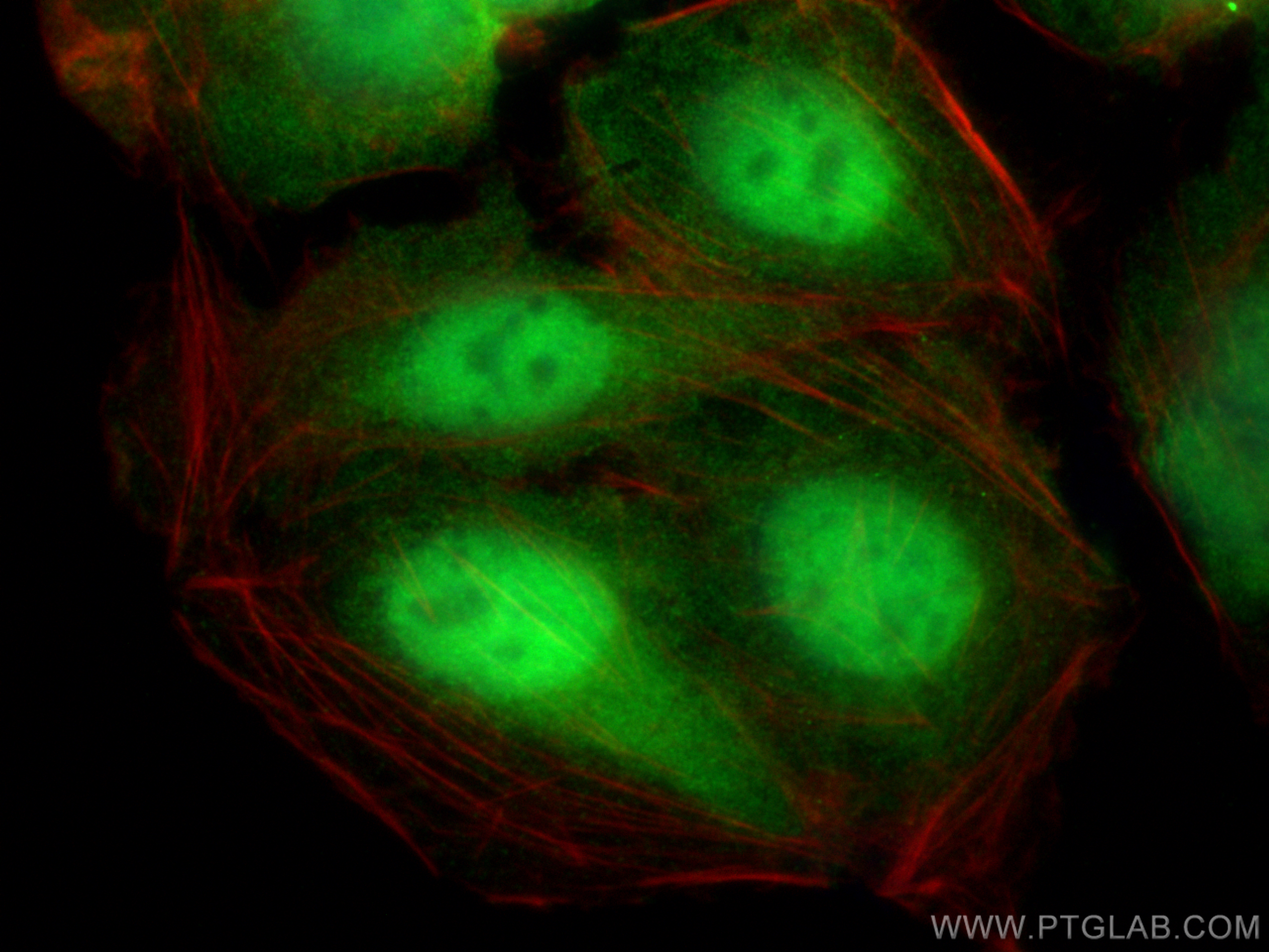 IF Staining of U2OS using 11357-1-AP