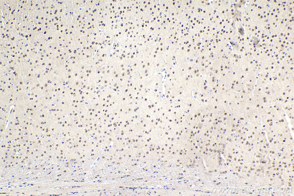 IHC staining of mouse brain using 67991-1-Ig