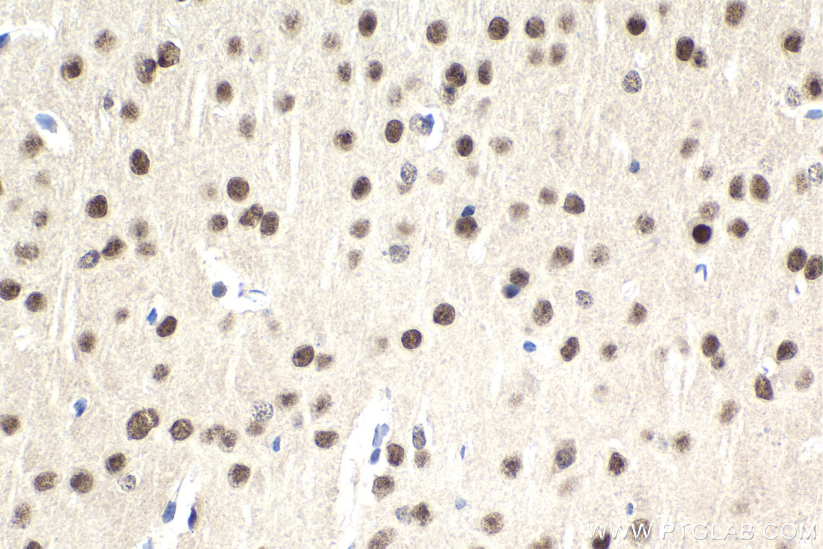 IHC staining of mouse brain using 67991-1-Ig