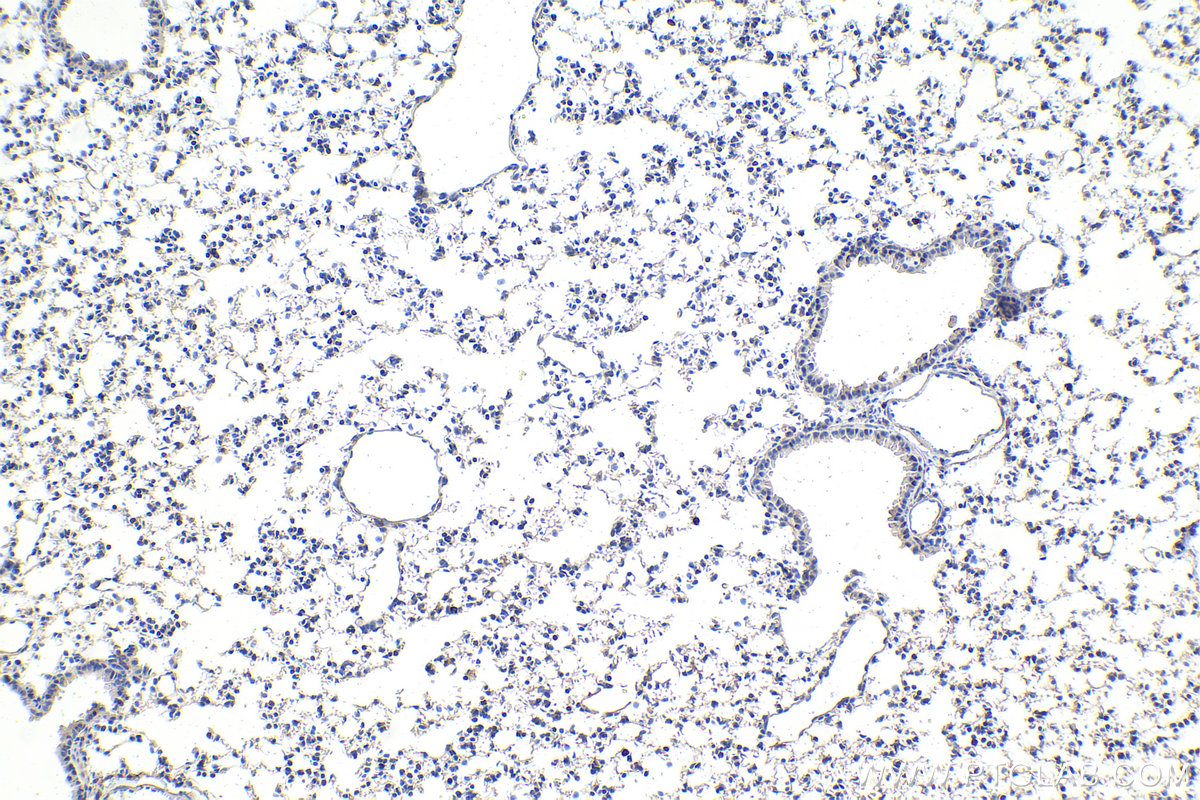 IHC staining of mouse lung using 67991-1-Ig