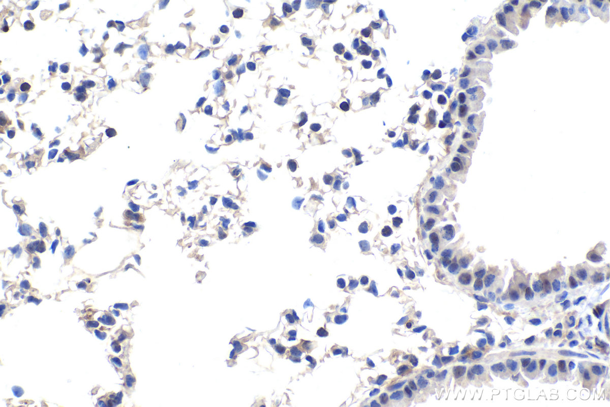 IHC staining of mouse lung using 67991-1-Ig