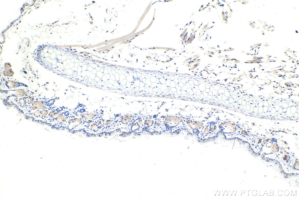 IHC staining of mouse skin using 67991-1-Ig