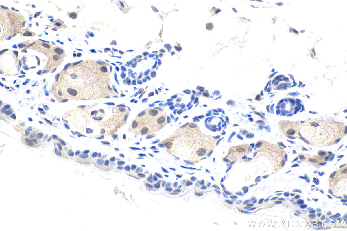 IHC staining of mouse skin using 67991-1-Ig