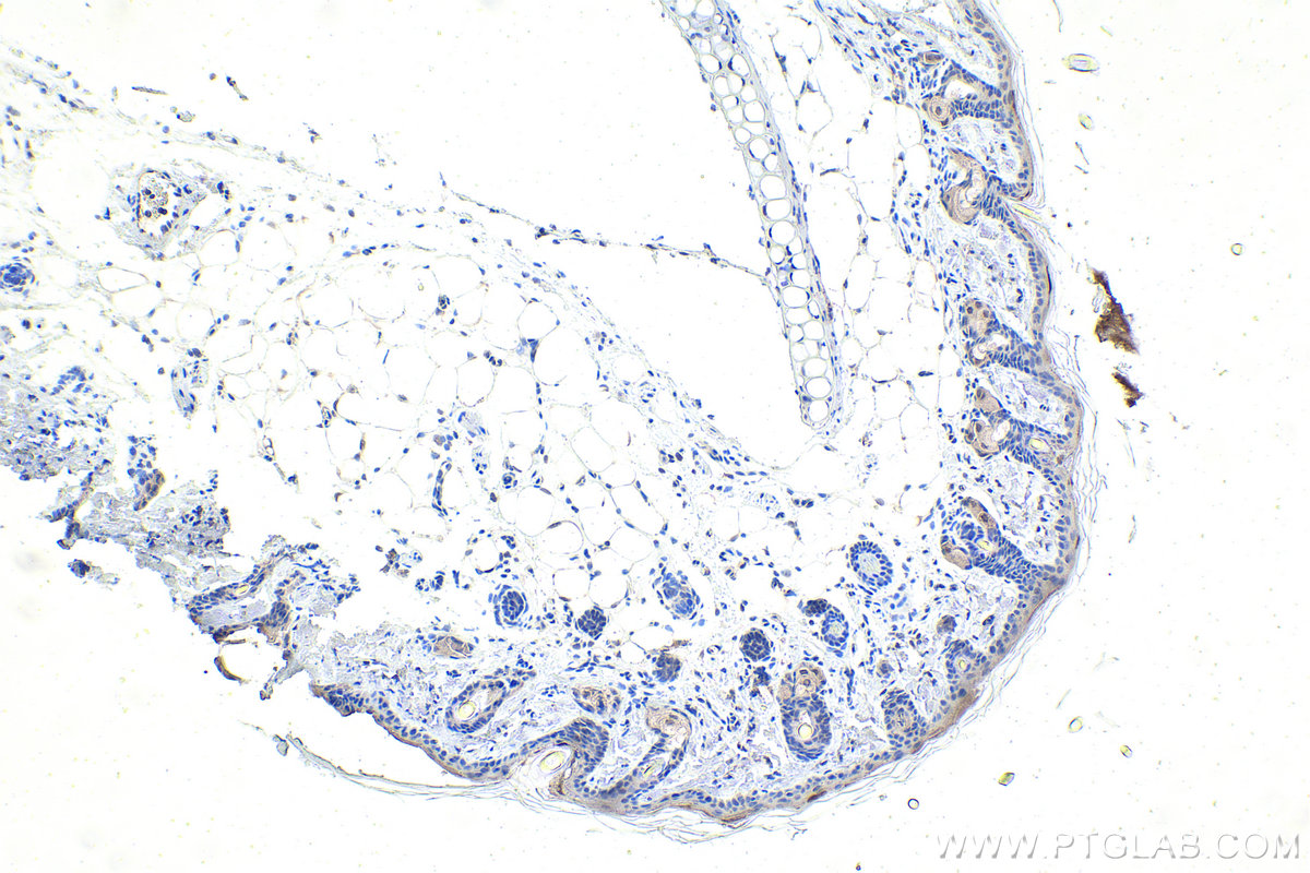 IHC staining of rat skin using 67991-1-Ig