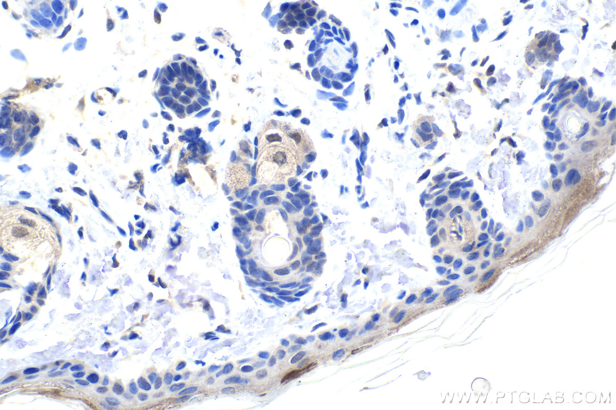 IHC staining of rat skin using 67991-1-Ig