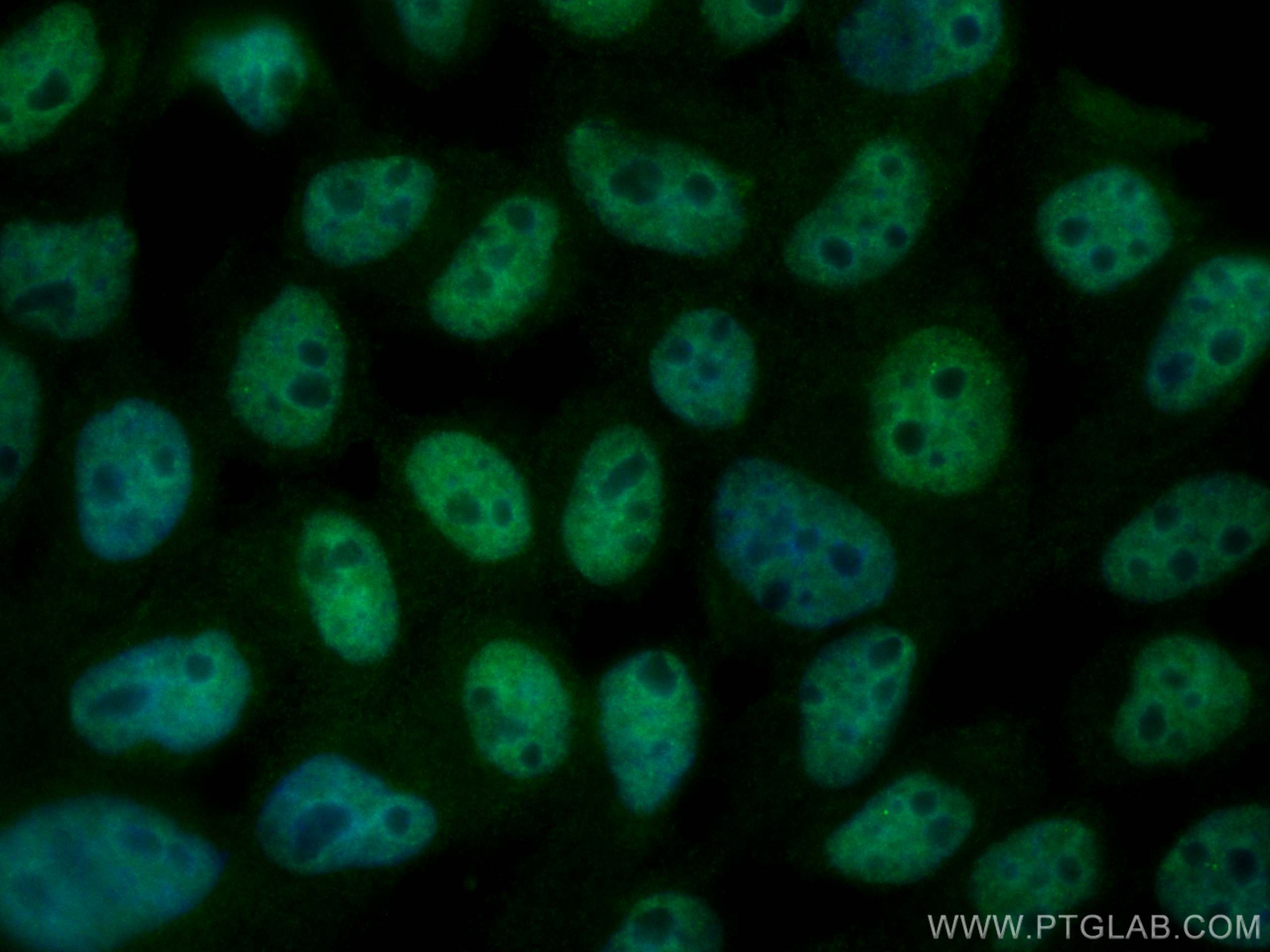 IF Staining of A431 using CL488-67991