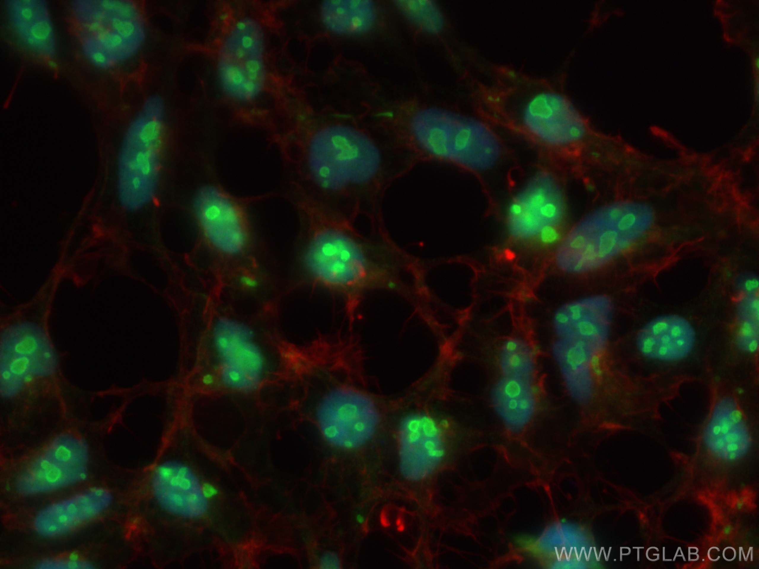 IF Staining of HEK-293 using 28502-1-AP