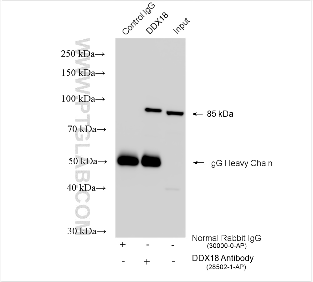 IP experiment of HEK-293T using 28502-1-AP