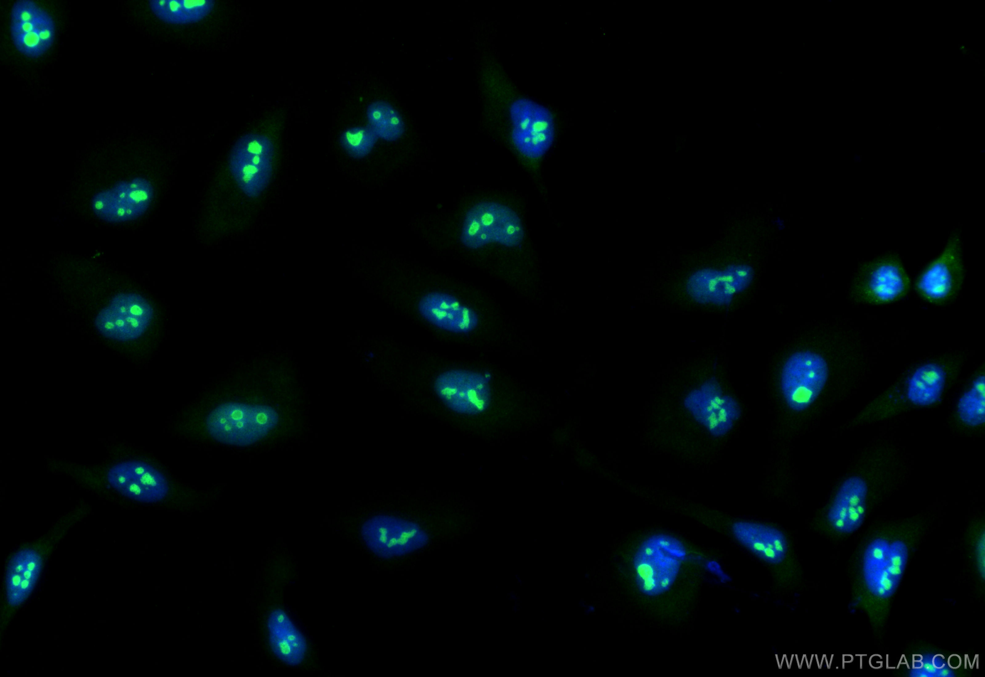 IF Staining of HeLa using 84103-6-RR (same clone as 84103-6-PBS)