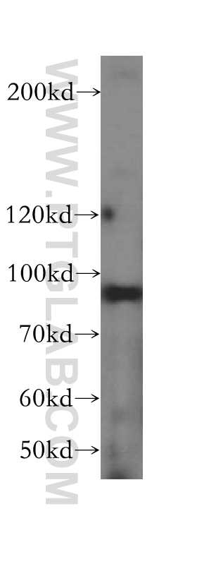 WB analysis of HeLa using 17087-1-AP