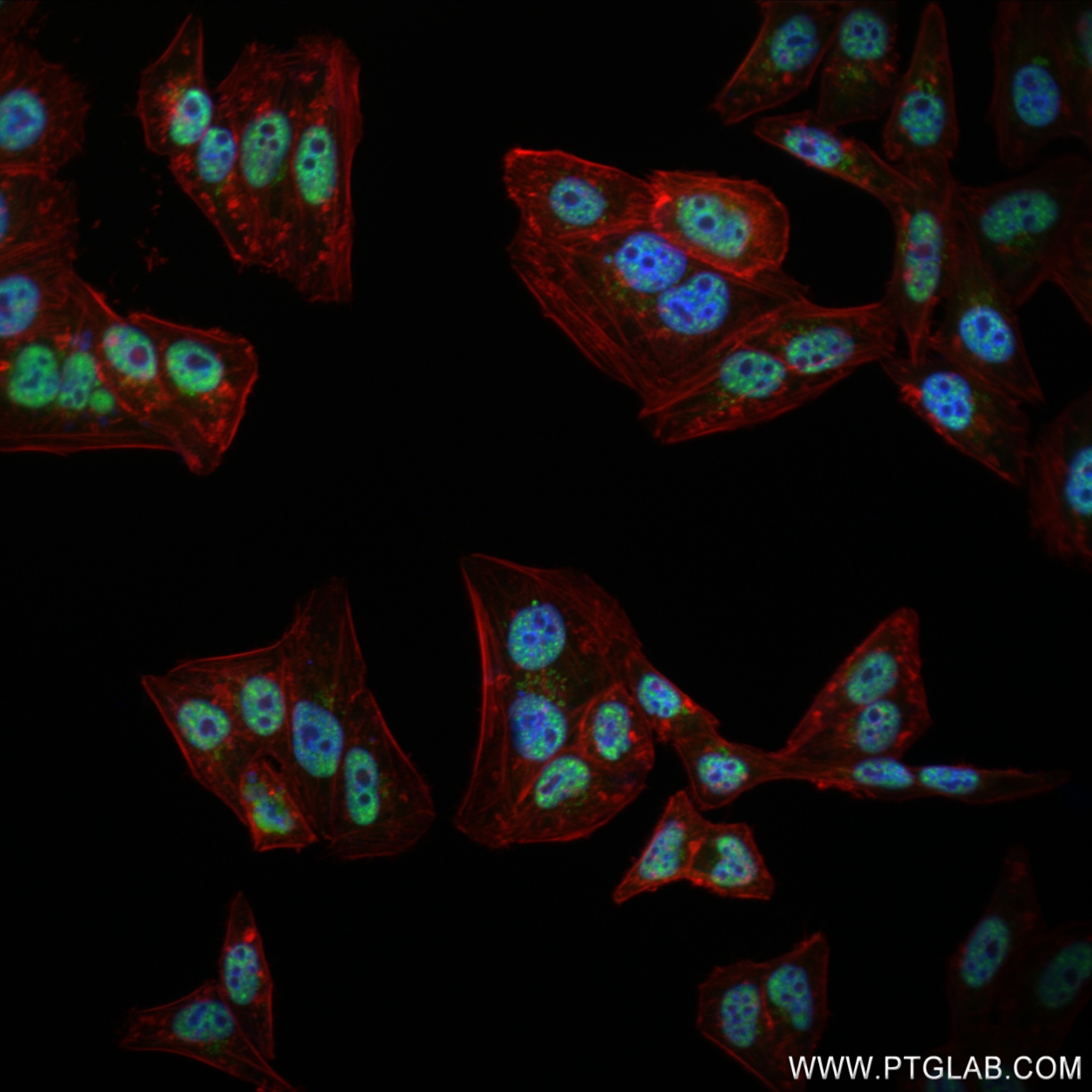 IF Staining of HepG2 using 83083-5-RR (same clone as 83083-5-PBS)