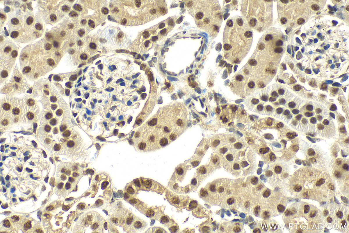 IHC staining of mouse kidney using 83083-5-RR (same clone as 83083-5-PBS)