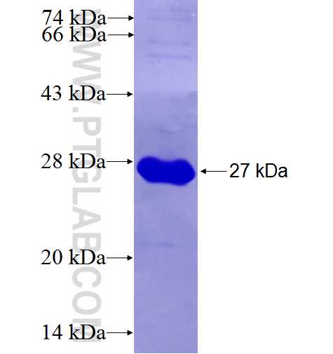 DDX41 fusion protein Ag26752 SDS-PAGE