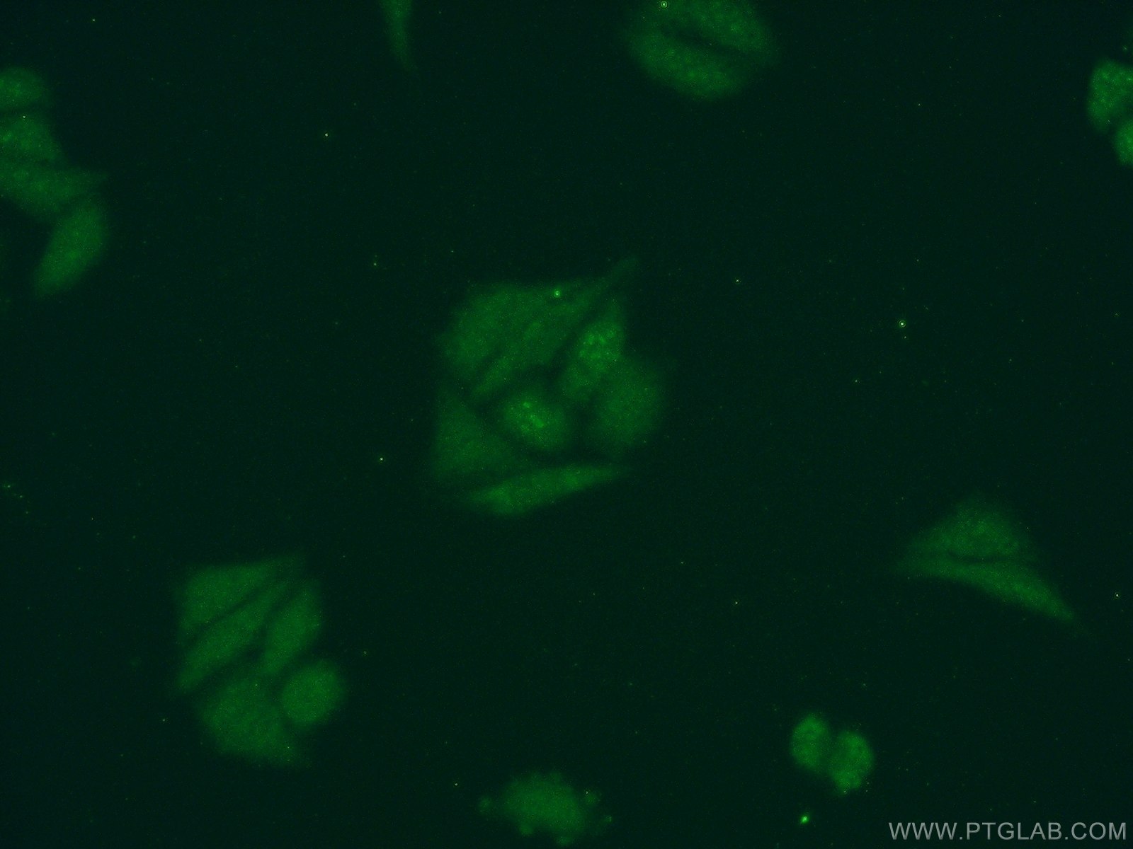 IF Staining of HepG2 using 17591-1-AP