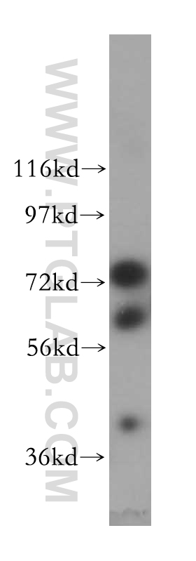 WB analysis of HeLa using 17591-1-AP