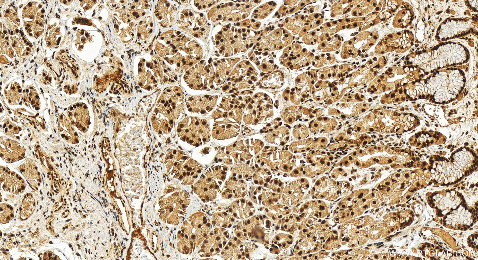 IHC staining of human stomach using 16927-1-AP