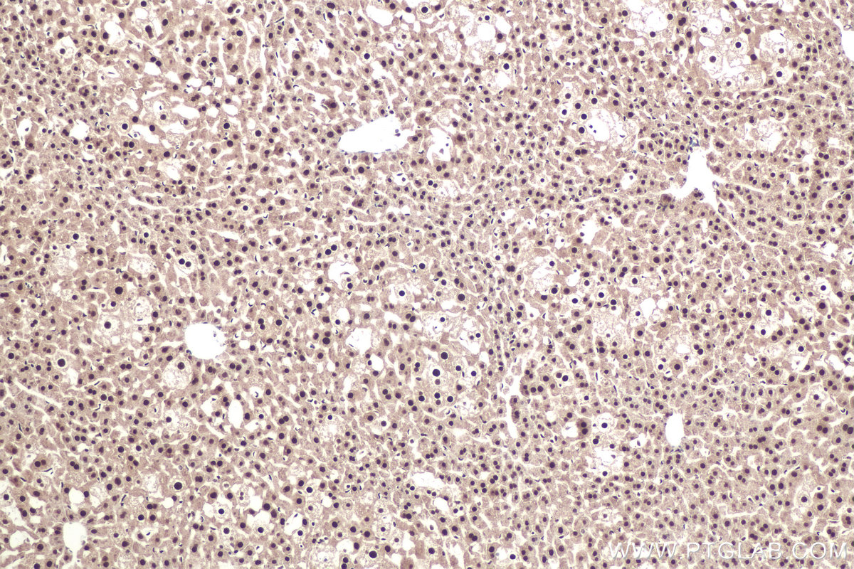 IHC staining of mouse liver using 26385-1-AP
