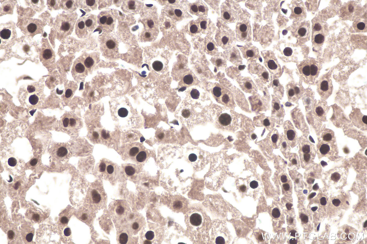 IHC staining of mouse liver using 26385-1-AP