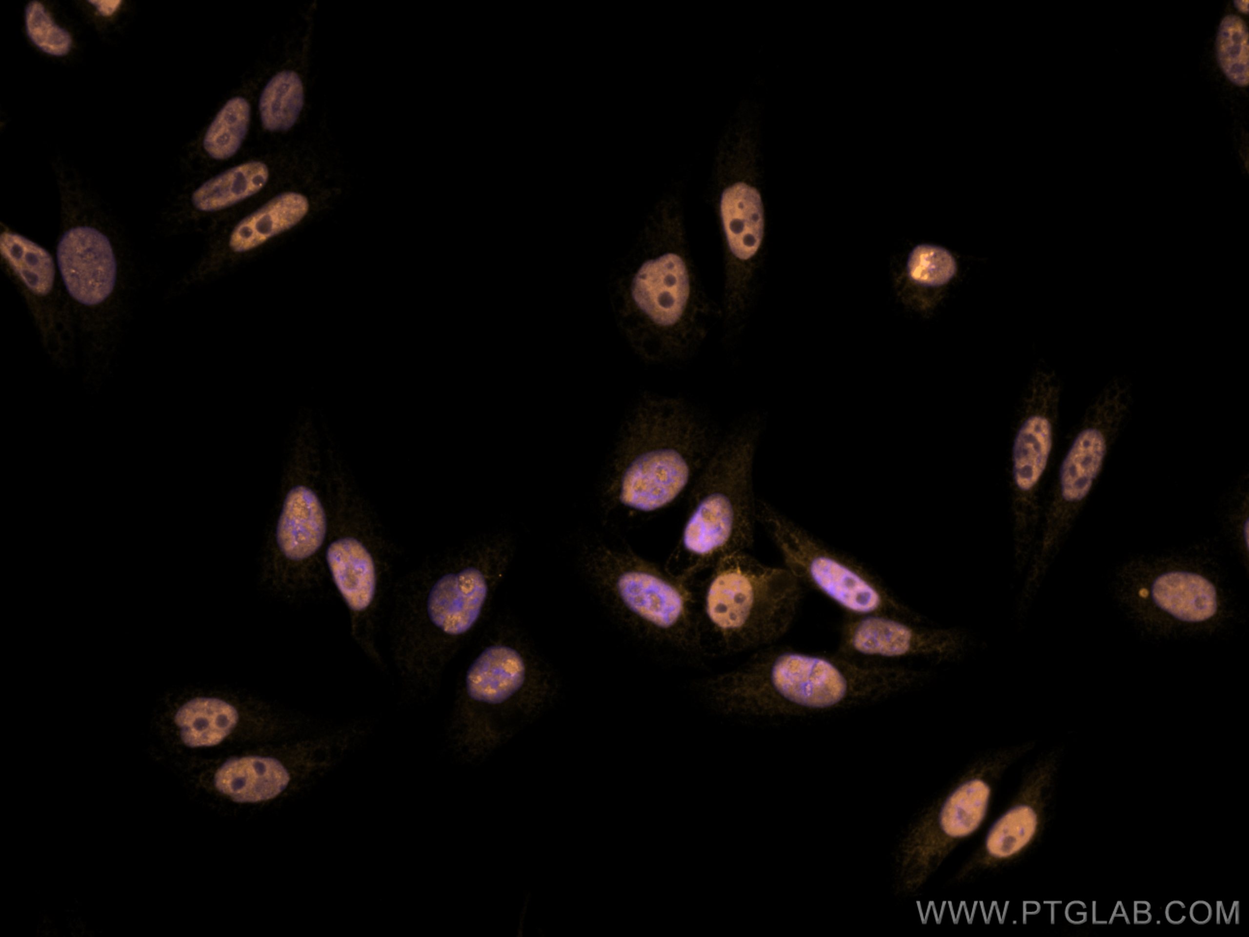 IF Staining of HepG2 using CL555-67025