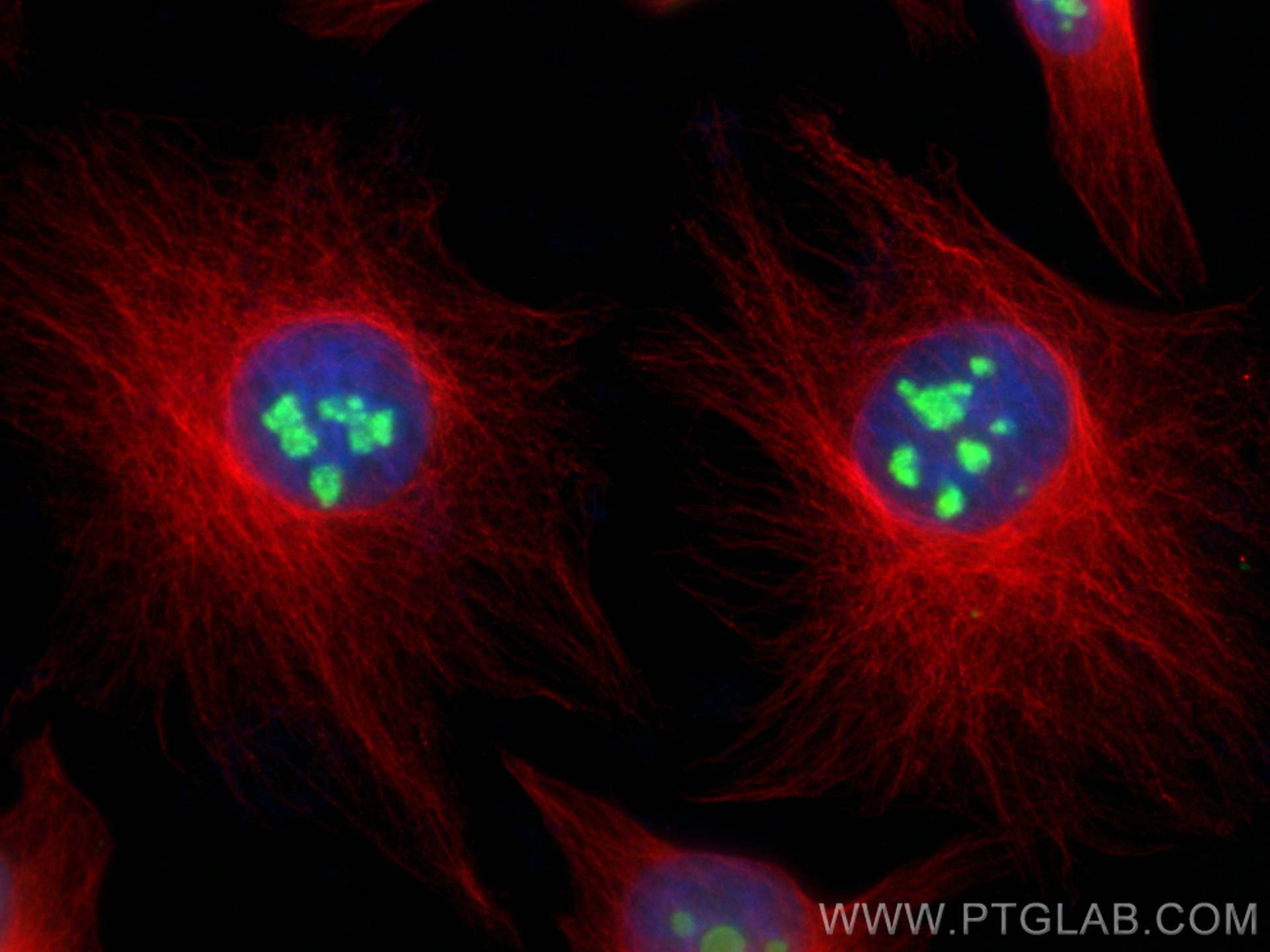 IF Staining of HeLa using 10358-1-AP