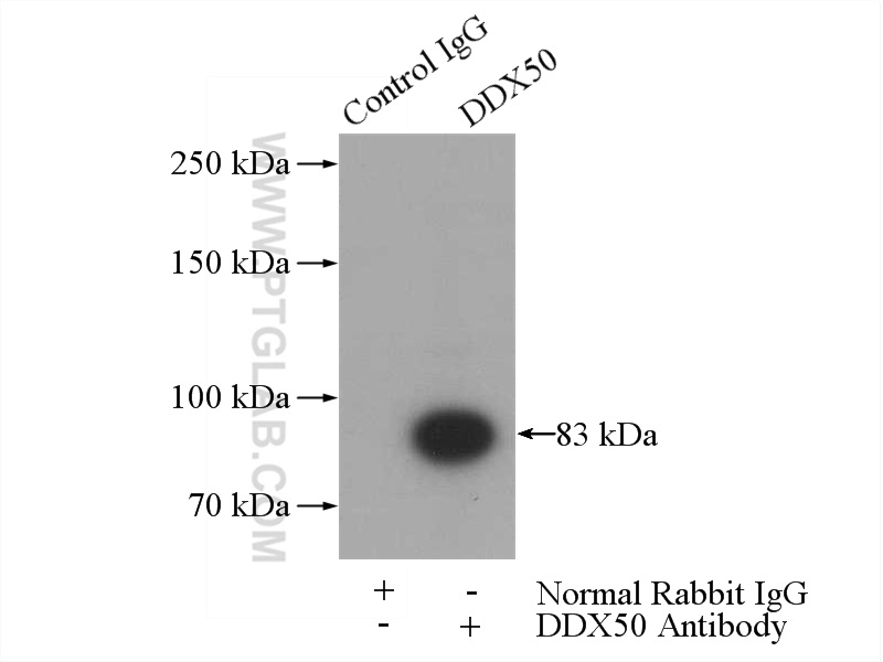 IP experiment of HeLa using 10358-1-AP