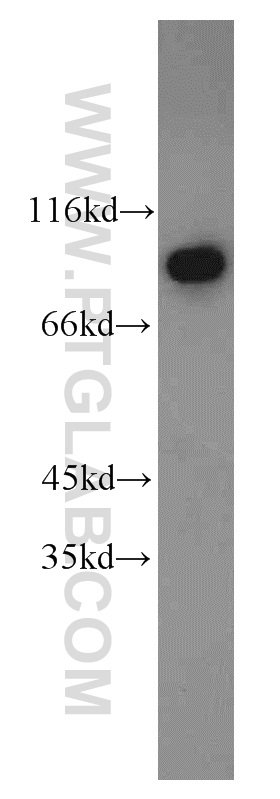 WB analysis of HeLa using 10358-1-AP