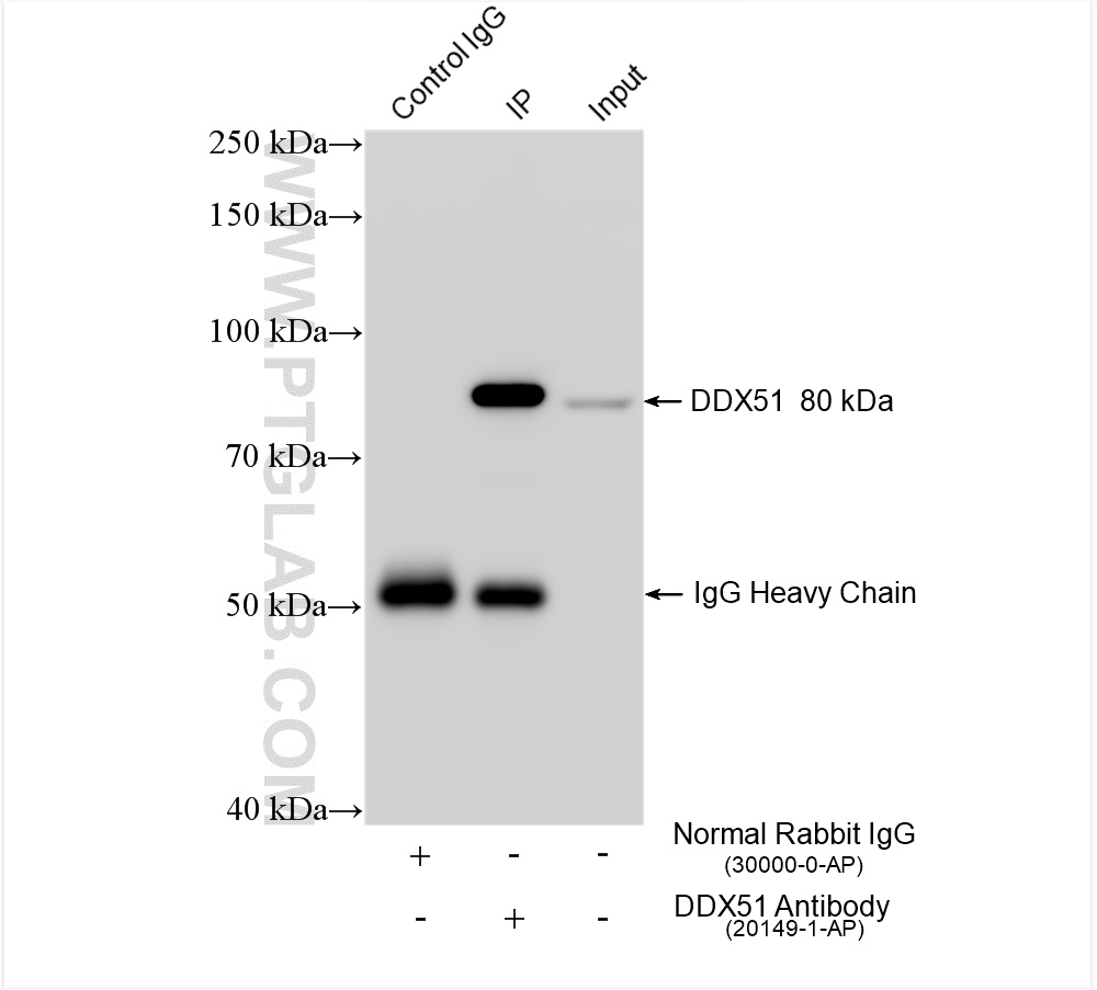 IP experiment of K-562 using 20149-1-AP