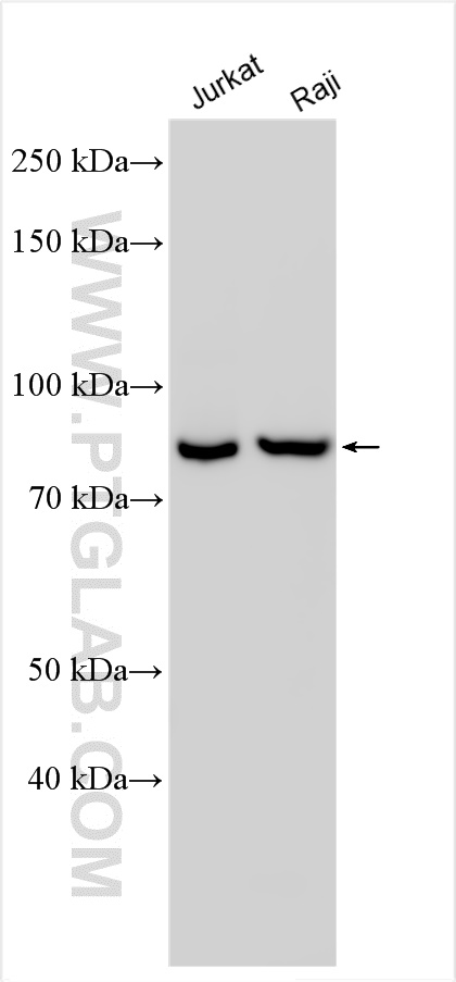 WB analysis using 20149-1-AP