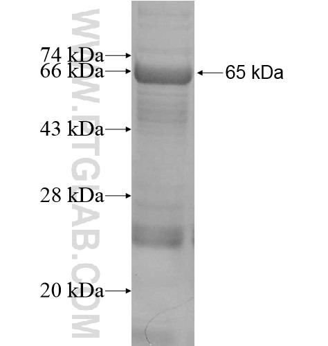 DDX52 fusion protein Ag10118 SDS-PAGE