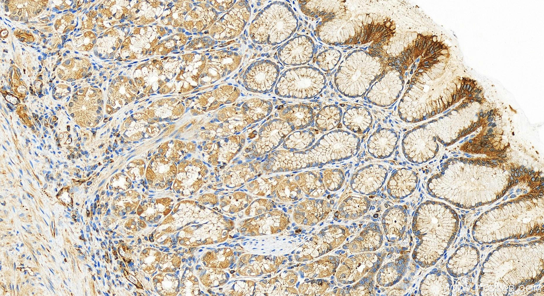 IHC staining of human stomach using 30982-1-AP