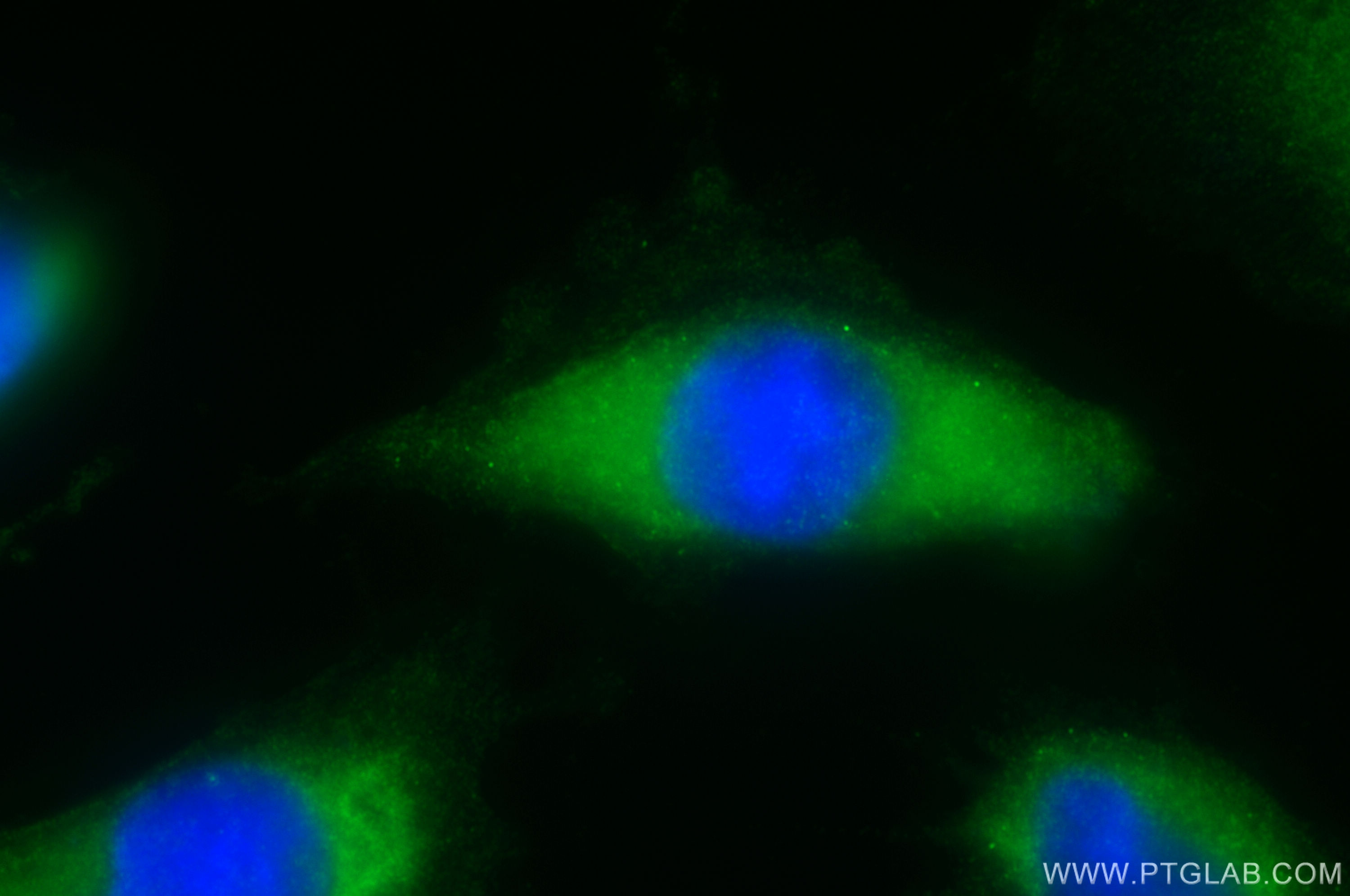 IF Staining of U-251 using 30982-1-AP