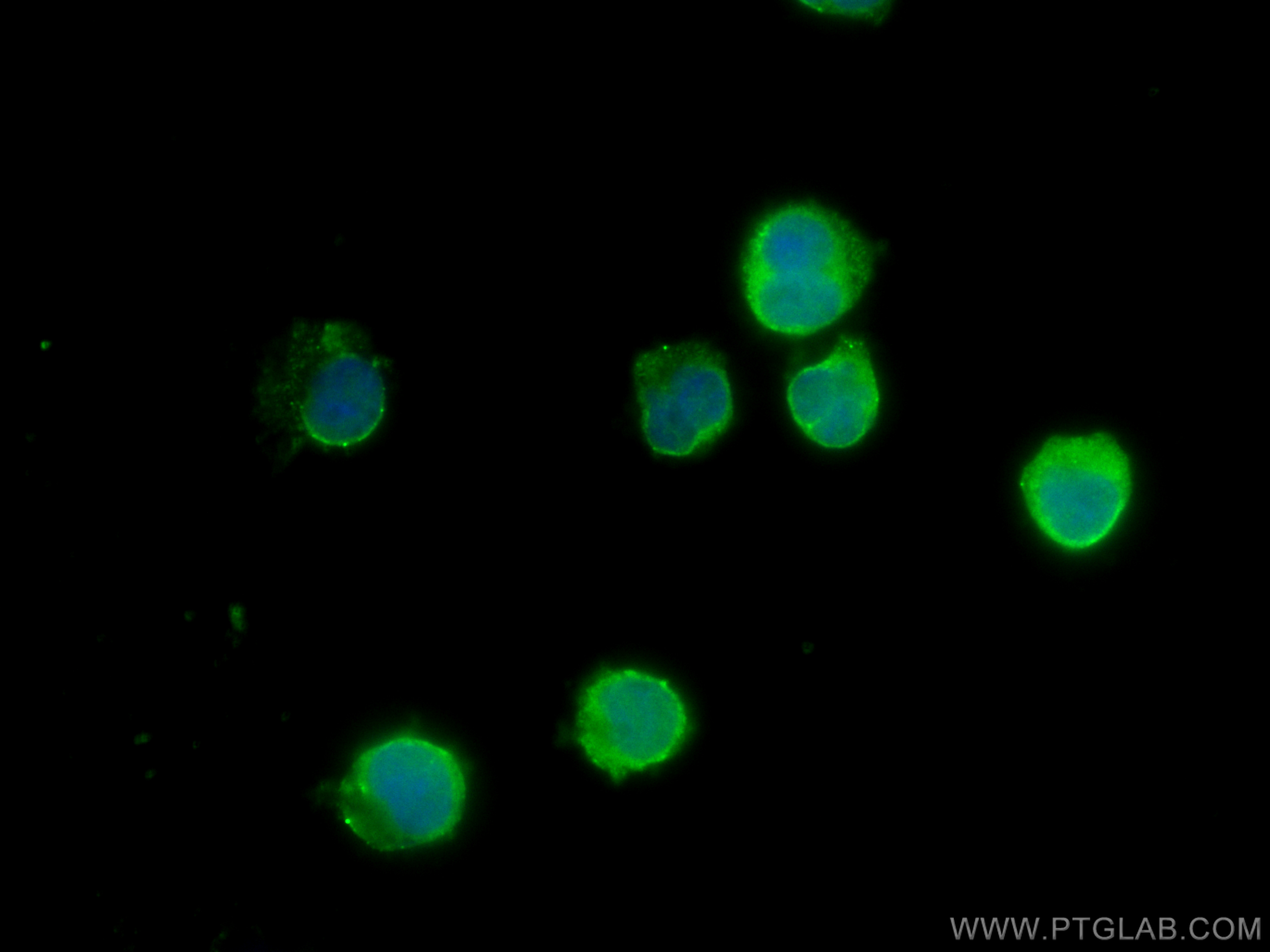 IF Staining of Jurkat using 18323-1-AP