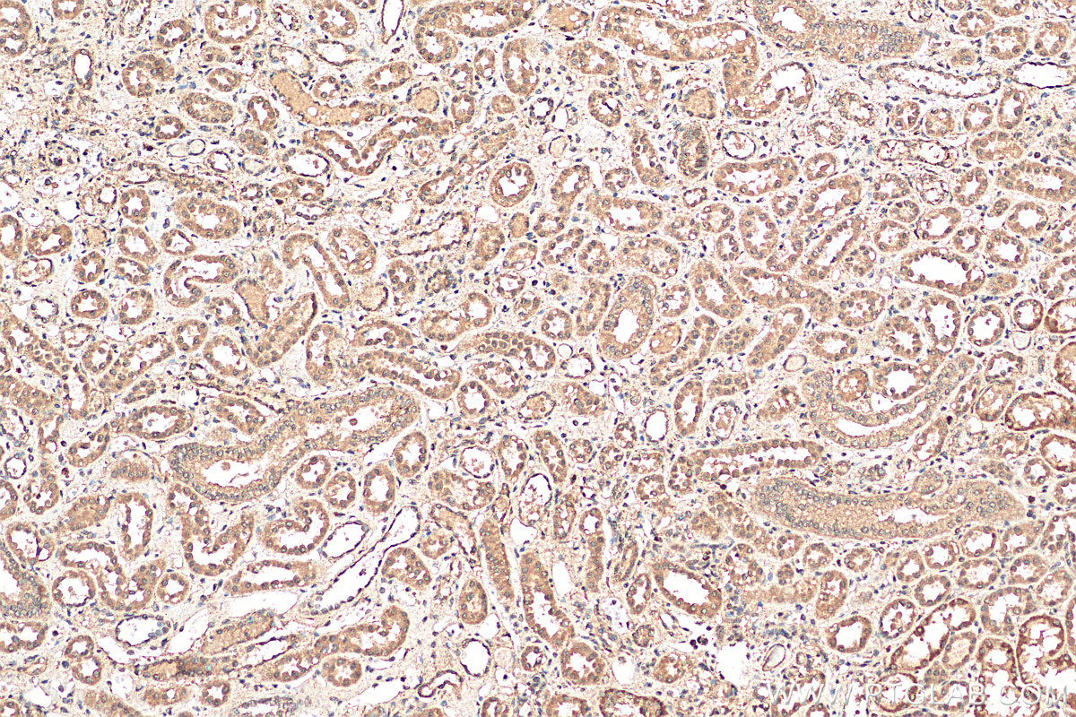 IHC staining of human kidney using 18323-1-AP