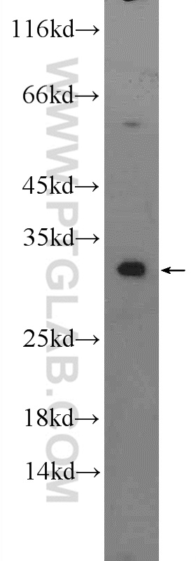 WB analysis of mouse lung using 25855-1-AP