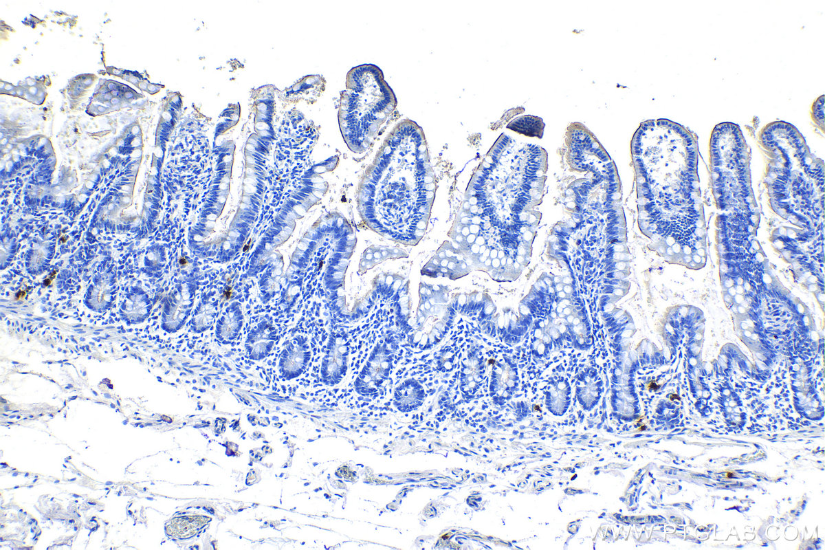 IHC staining of human small intestine using 67156-1-Ig (same clone as 67156-1-PBS)