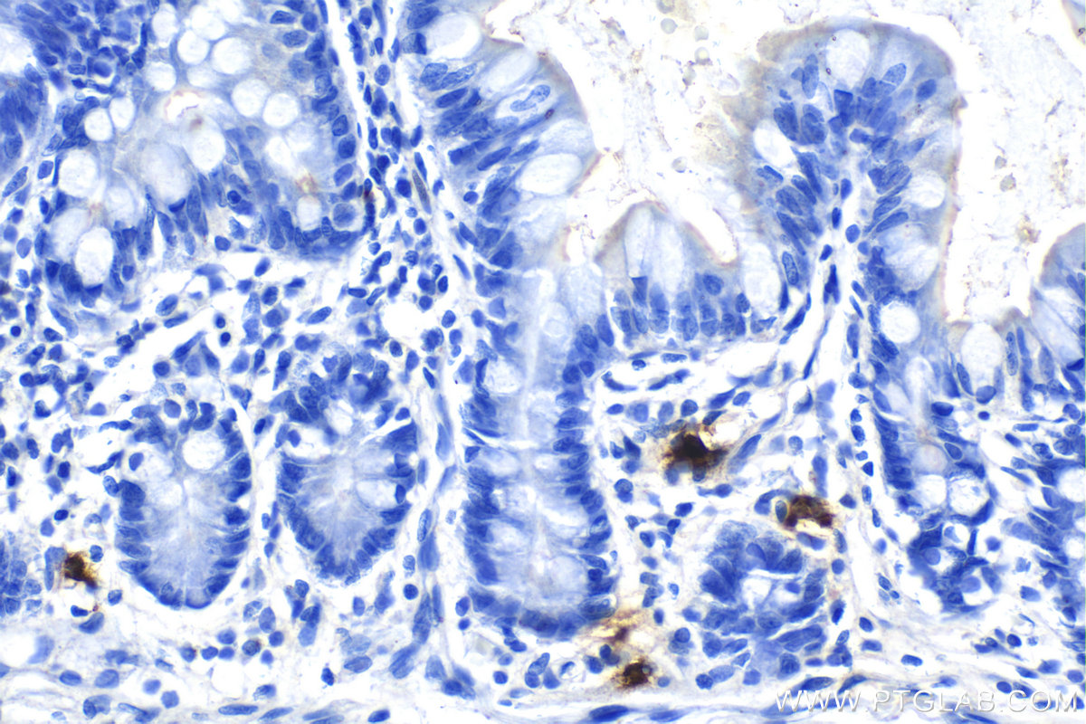 IHC staining of human small intestine using 67156-1-Ig (same clone as 67156-1-PBS)