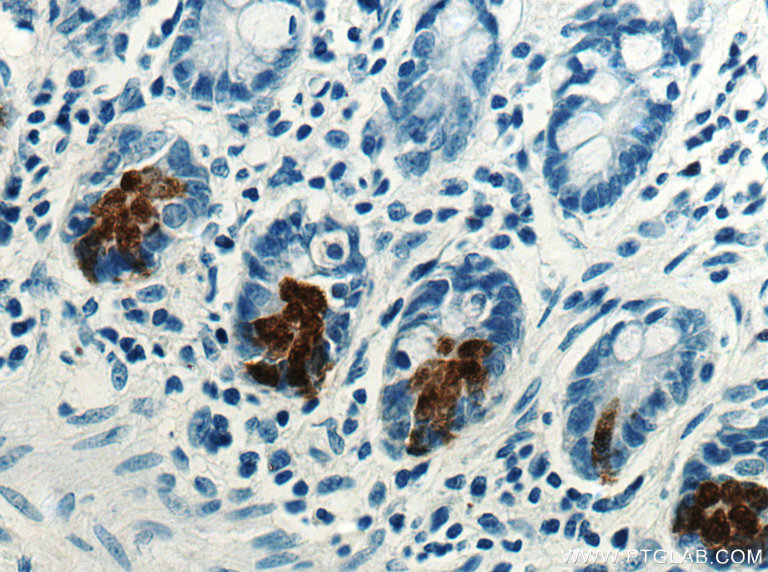 IHC staining of human small intestine using 18268-1-AP