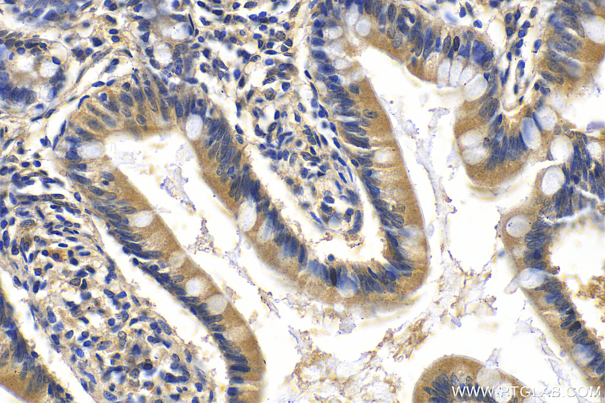 IHC staining of human small intestine using 25761-1-AP