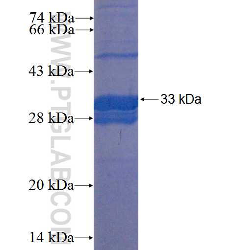 DEFB121 fusion protein Ag22712 SDS-PAGE