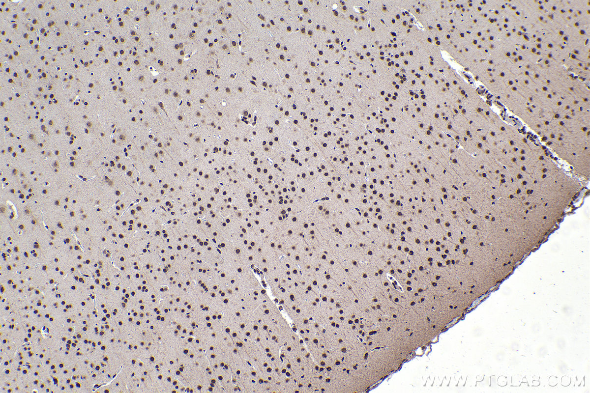 IHC staining of rat brain using 16448-1-AP