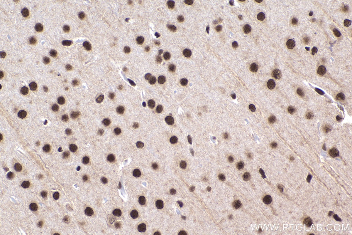 IHC staining of rat brain using 16448-1-AP