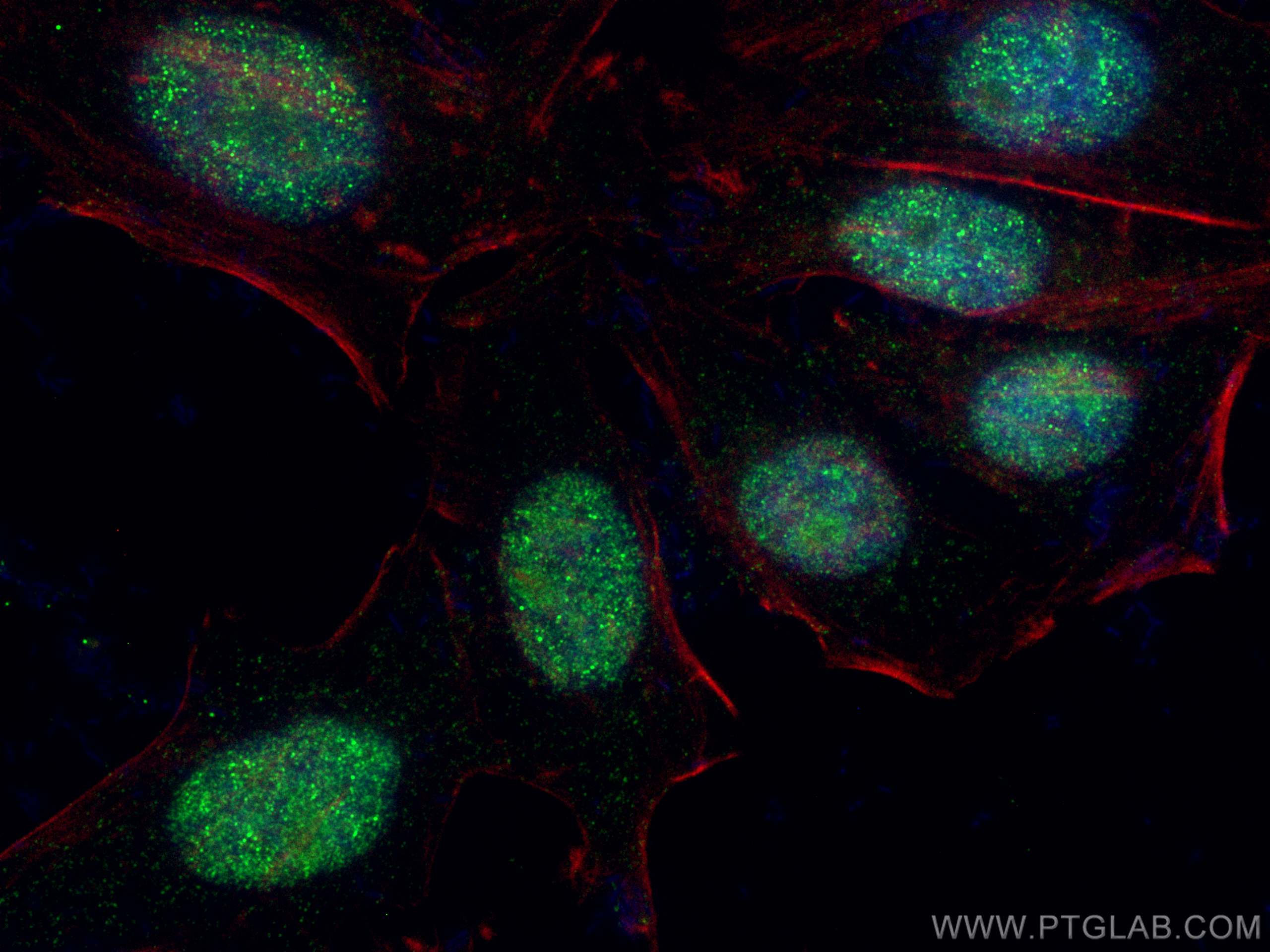 IF Staining of HepG2 using 66194-1-Ig