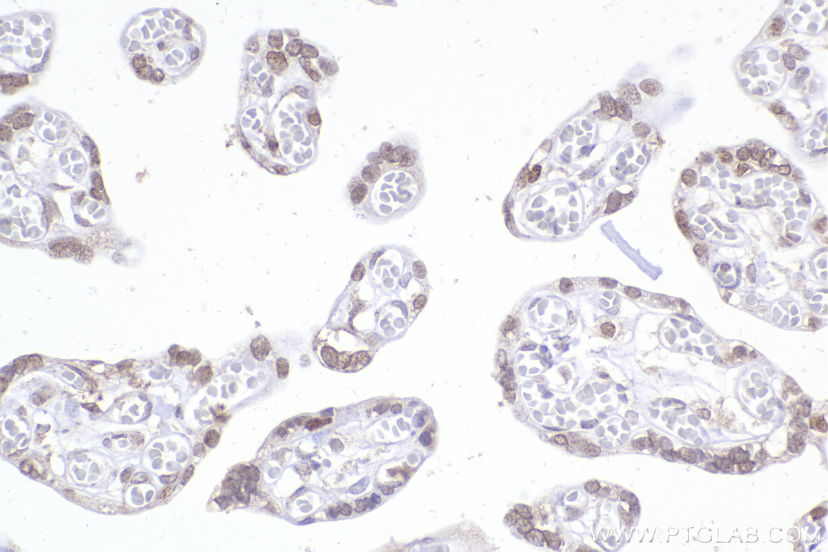 IHC staining of human placenta using 66194-1-Ig (same clone as 66194-1-PBS)