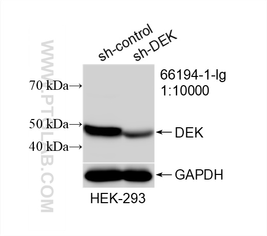 WB analysis of HEK-293 using 66194-1-Ig