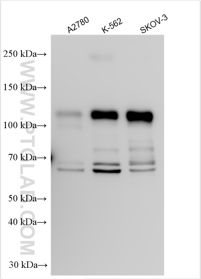 WB analysis using 25658-1-AP