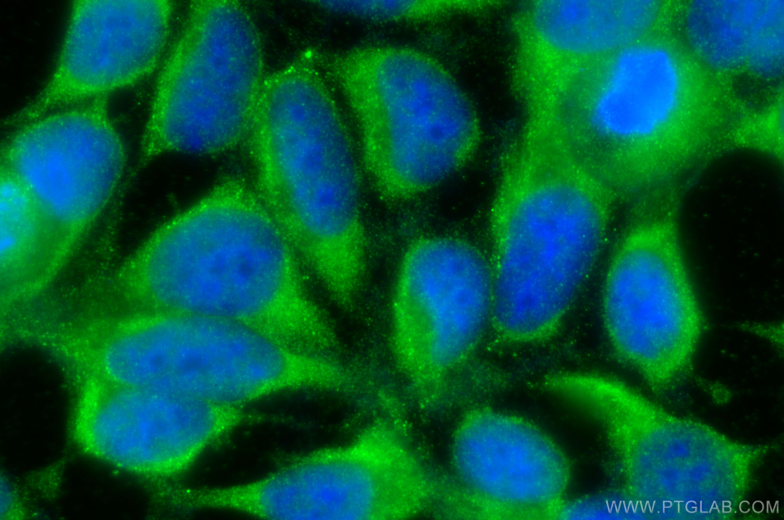 IF Staining of HEK-293 using 10656-1-AP