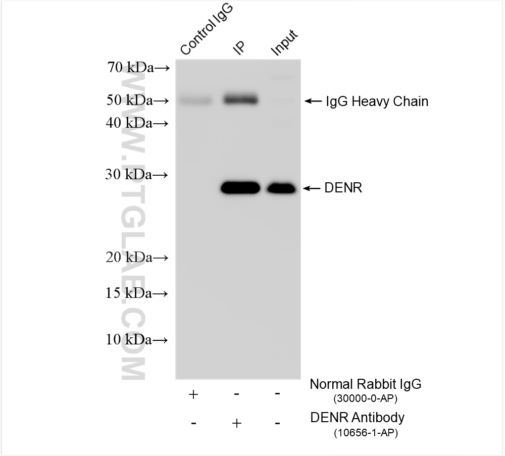 IP experiment of HeLa using 10656-1-AP